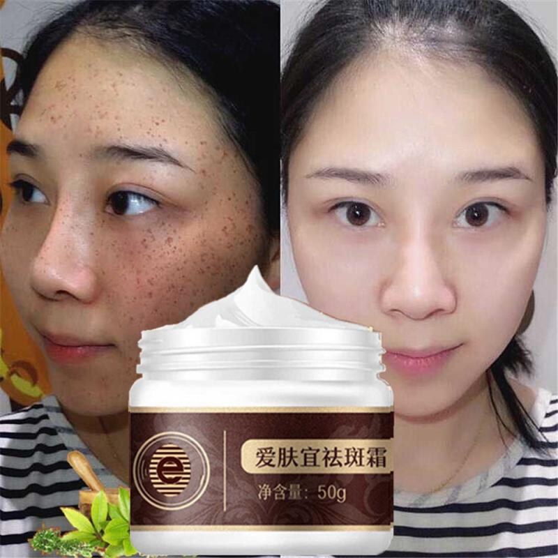50g Face Cream Freckle Remover Cream Treatment Dilute Spot Melanin Melasma High Quality Skin Care Whitening Cream TSLM2