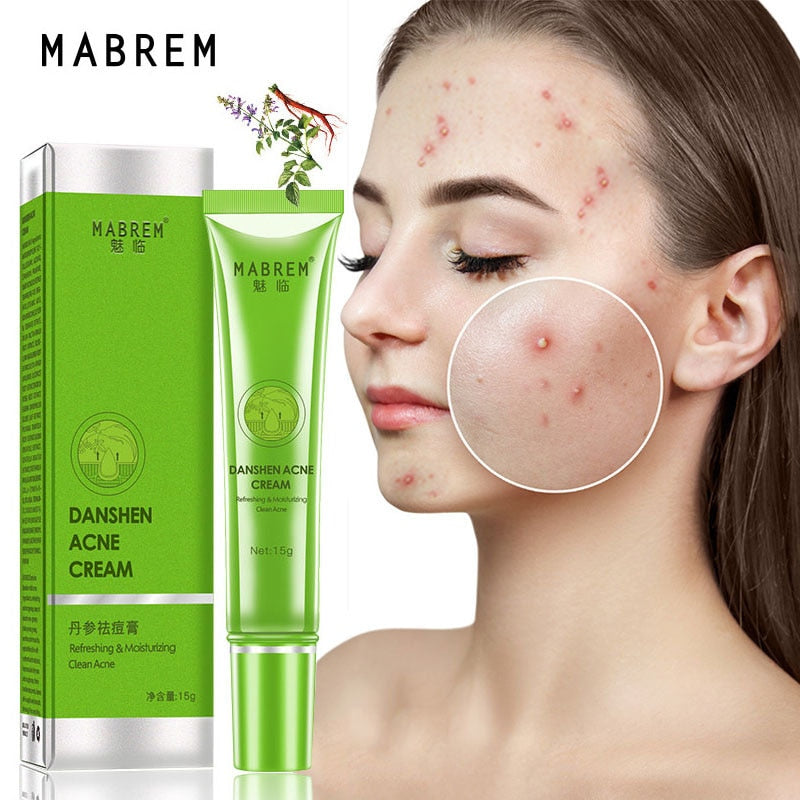 Anti Acne Removal Cream Acne Treatment Fade Acne Spots Oil Control Shrink Pores Whitening Moisturizing Acne Cream Skin Care 15g