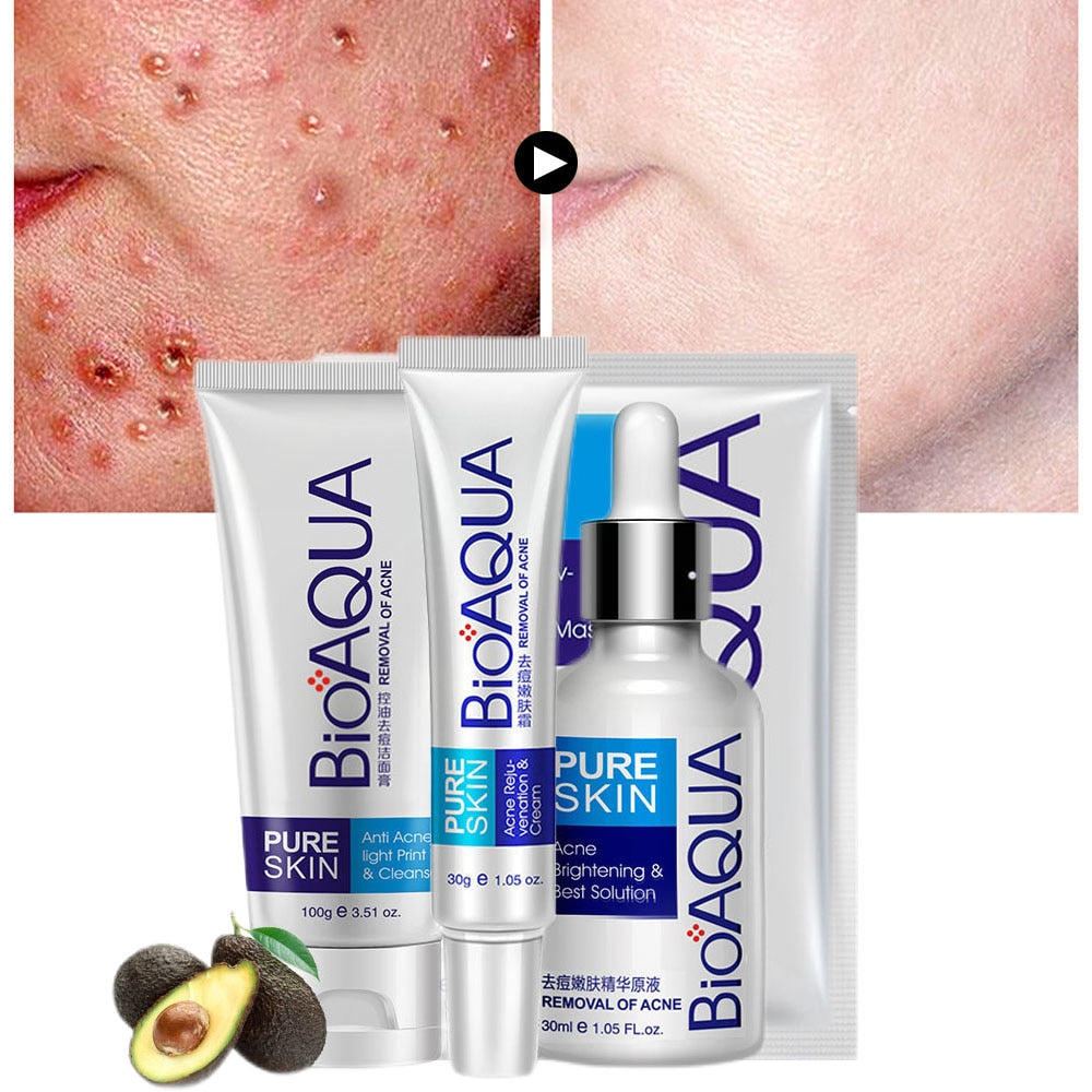 BIOAQUA Anti Acne Set Face Cream Facial Serum Mask Acne Treatment Oil Control Shrink Pores Moisturizing Whitening Skin Care