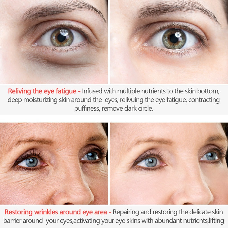 Korean Skin Care Anti Wrinkle Eye Cream Six Peptides Serum Anti Aging Remover Dark Circle Bag Firming nourish eye Balm Mask 20g