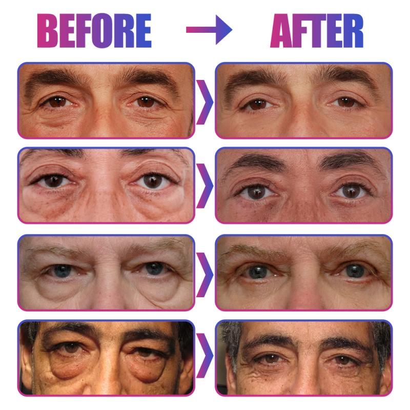 Men's Eye Cream Bioaqua Day And Night Laikou Ojeras Remover Eye Bags Anti Aging Cream Men Skin Care Dark Circles TSLM1