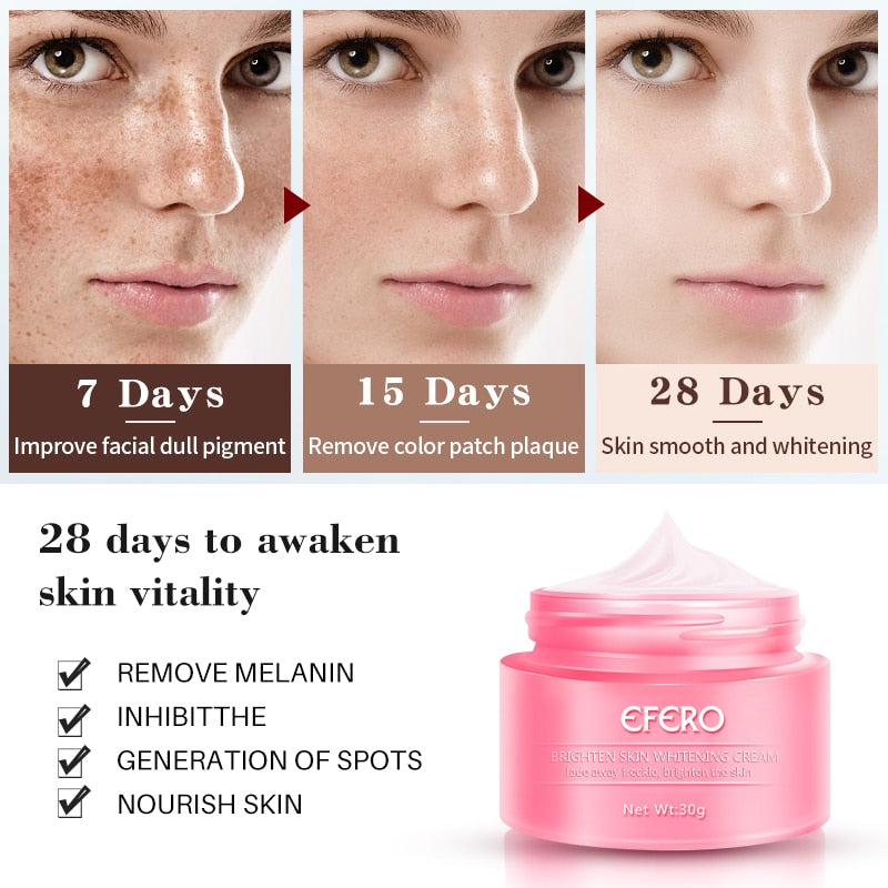 Skin Whitening Cream Freckle Cream Remove Melasma Acne Dark Pigment Spots Melanin Pimple Cream Face Cream Face Serum Skin Care