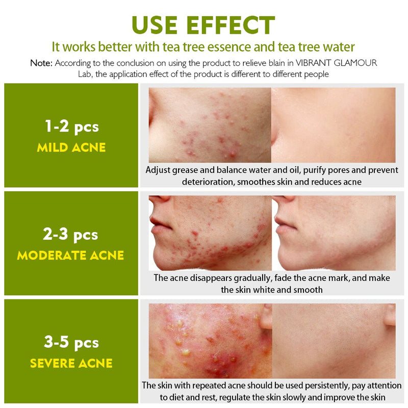 VIBRANT GLAMOUR Tea Tree Anti-Acne Face Cream Oil Control Shrink Pores Acne Cream Nourish Whitening Acne Scar Remove Skin Care