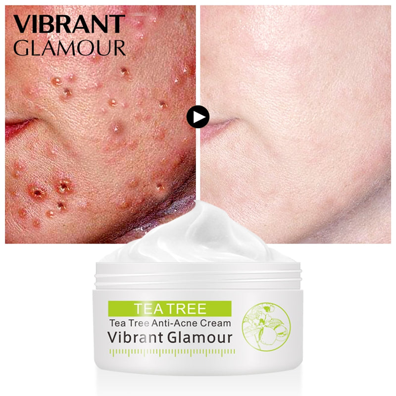 VIBRANT GLAMOUR Tea Tree Anti-Acne Face Cream Oil Control Shrink Pores Acne Cream Nourish Whitening Acne Scar Remove Skin Care