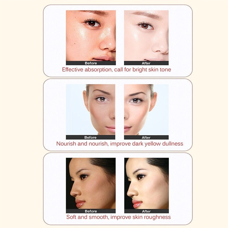 Whitening cream freckles pigmentation melasma removal skin lightening for dark spot manchas remover for face anti aging 2 in 1