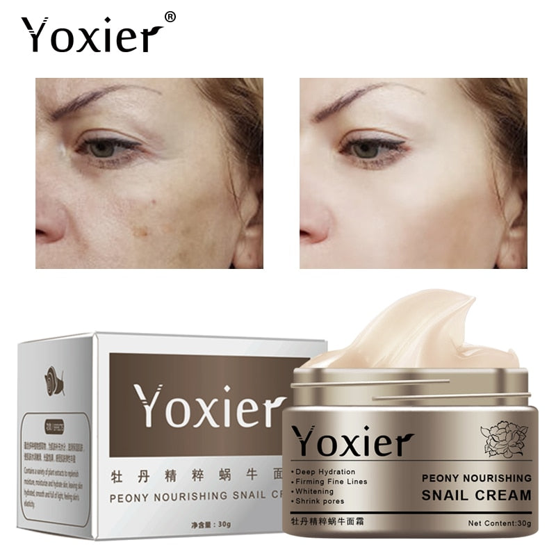 Yoxier Peony Anti Wrinkle Facial Cream Nourishing Anti Aging Whitening Skin Care Acne Treatment Hyaluronic Acid Snail Cream