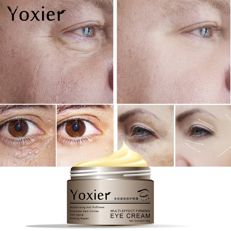 Yoxier Snail Eye Cream Peptide Collagen Serum Snail Essence  Anti-Wrinkle Remover Dark Circles Korea Cosmetics Patch For Eye